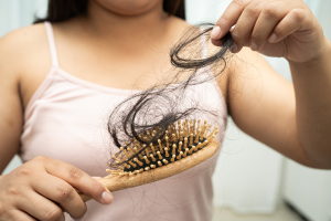 Does Mounjaro Affect Hair Growth What to Expect During Weight Loss Treatment MF