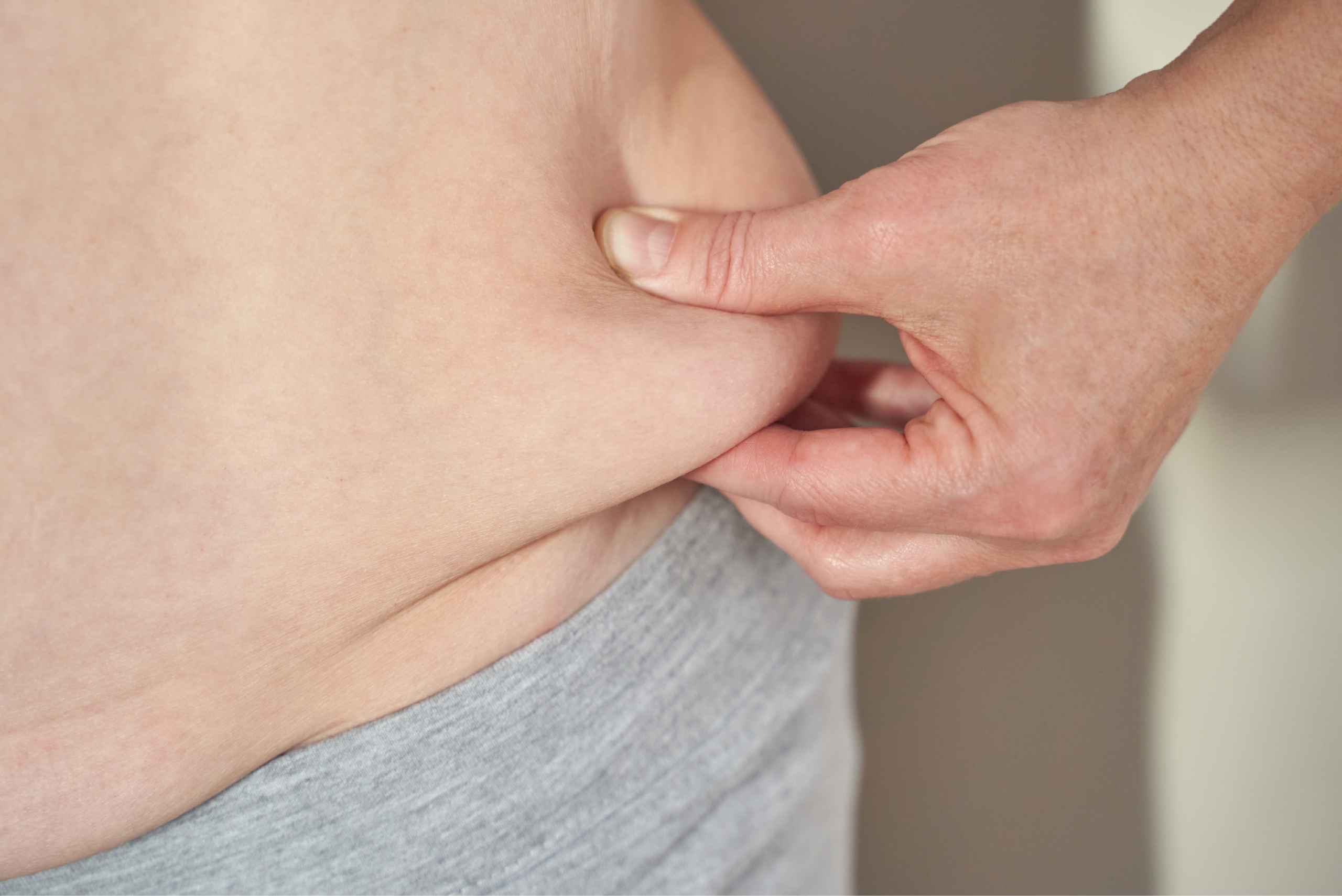 Does Mounjaro Cause Loose Skin After Weight Loss and Can You Prevent It?