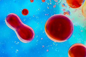 Mayfair LSC Cover Does Mounjaro Lower Cholesterol What the Evidence Says Mayfair