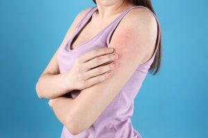 Can Wegovy Cause Skin Rashes