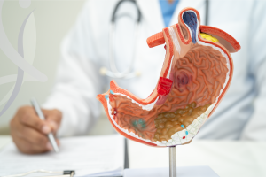 Can You Take Mounjaro After Gastric Bypass Surgery? What to Consider