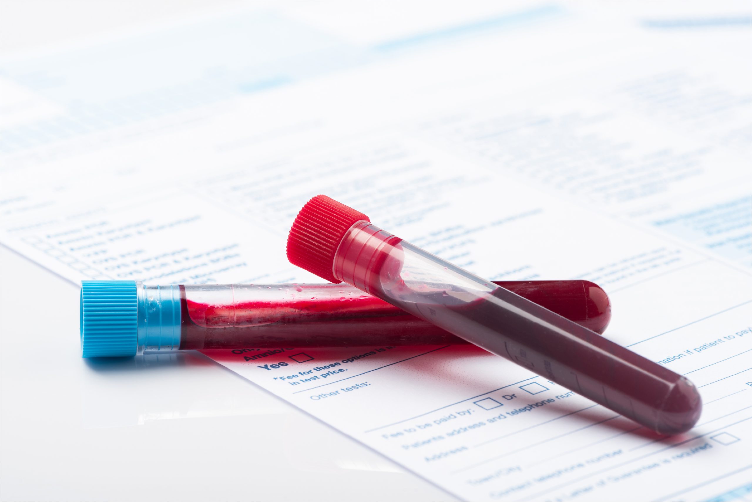 Blood Tests Before Starting Mounjaro: Key Pre-Treatment Screening You Need