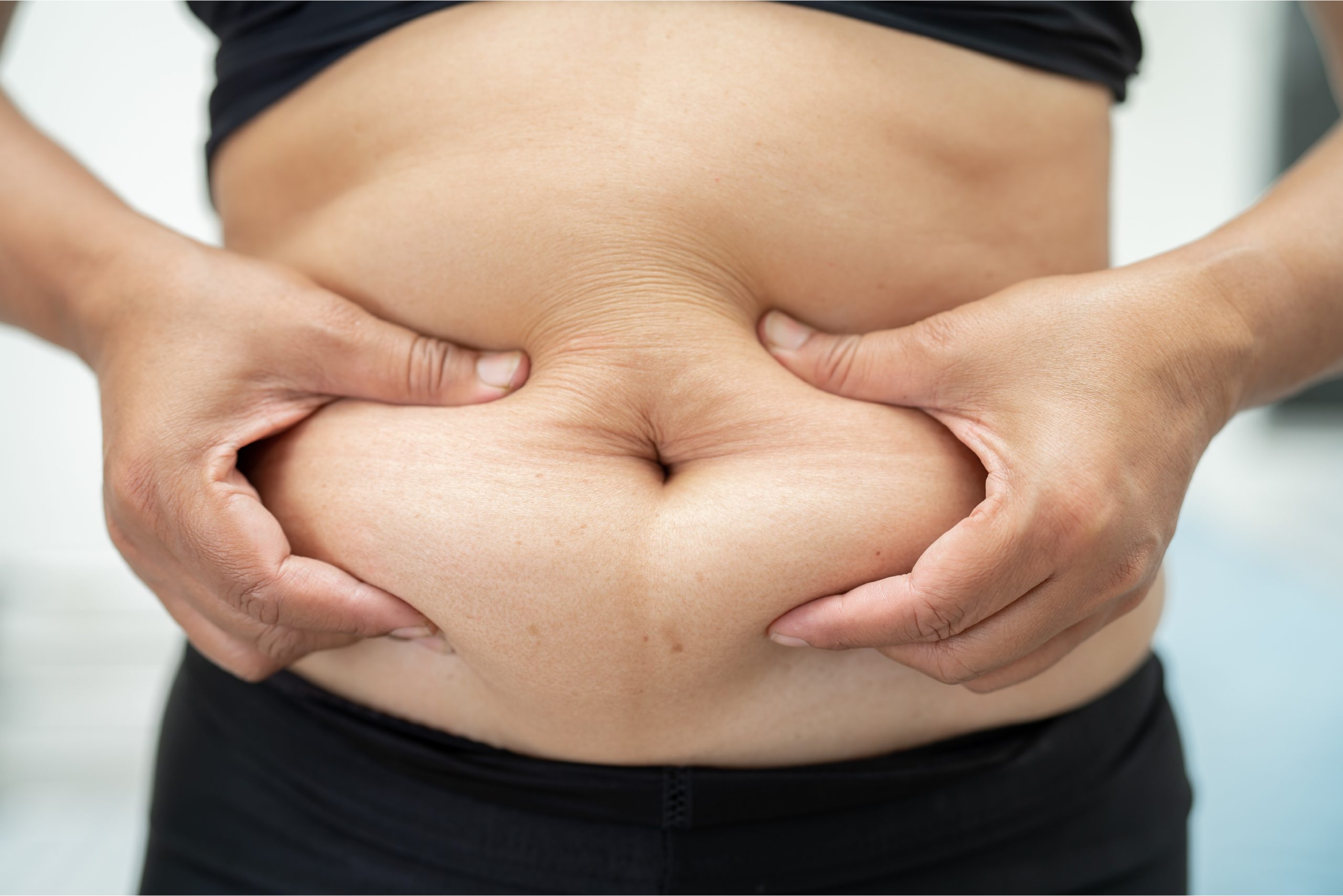Loose Skin on Wegovy: What to Expect and How to Manage It